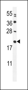 MIA40 Antibody western blot of MDA-MB231 cell line lysates (35 ug/lane). The MIA40 antibody detected the MIA40 protein (arrow).
