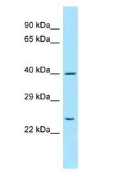 PEX13 antibody Western Blot of Jurkat.