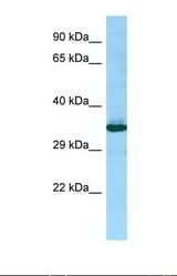Western blot of Human 721_B . PEX14 antibody dilution 1.0 ug/ml.
