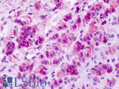 Anti-SLC1 / MCHR1 antibody IHC of human adrenal. Immunohistochemistry of formalin-fixed, paraffin-embedded tissue after heat-induced antigen retrieval. Antibody LS-A1532 dilution 15-30 ug/ml.