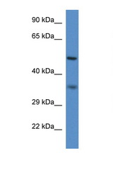 PEX2 antibody LS-C135123 Western blot of Mouse Spleen lysate. Antibody concentration 1 ug/ml.