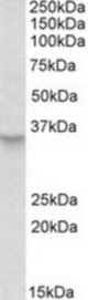 PXMP3 antibody (0.5 ug/ml) staining of HeLa lysate (35 ug protein/ml in RIPA buffer). Primary incubation was 1 hour. Detected by chemiluminescence.