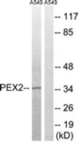 Western blot of extracts from A549 cells, using PXMP3 Antibody. The lane on the right is treated with the synthesized peptide.