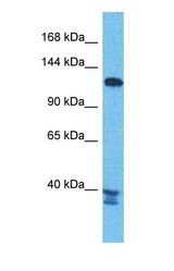 Western blot of PEX6 Antibody with human Jurkat Whole Cell lysate.