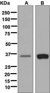 Western blot analysis on (A) fetal muscle and (B) MCF-7 lysates using anti-PEX7 antibody.