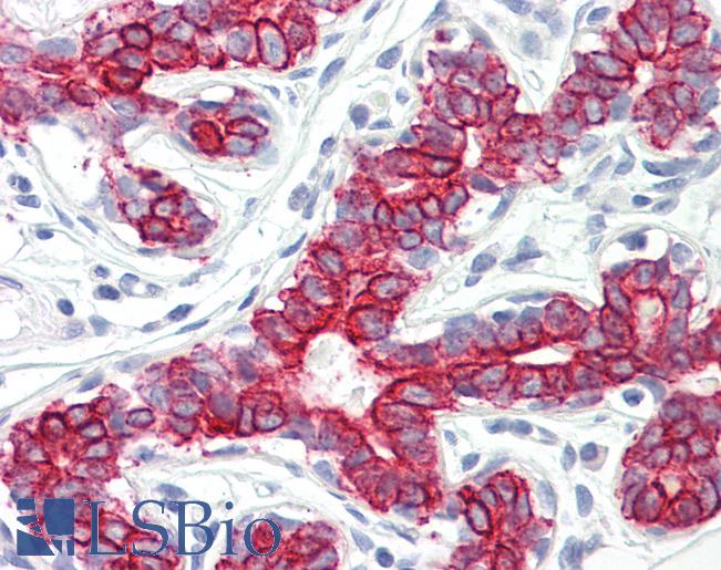 Anti-PEX7 antibody IHC of human breast. Immunohistochemistry of formalin-fixed, paraffin-embedded tissue after heat-induced antigen retrieval. Antibody LS-B8579 dilution 5 ug/ml.