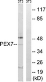 Western blot of extracts from NIH-3T3 cells, using PEX7 Antibody. The lane on the right is treated with the synthesized peptide.
