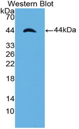 Western blot of recombinant PF4V1.