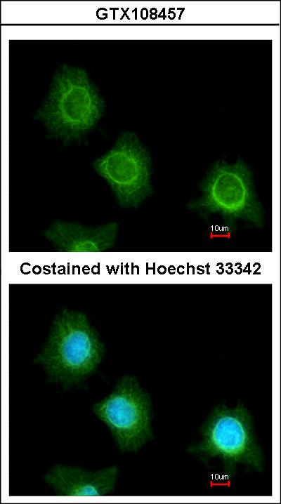 Immunofluorescence of methanol-fixed HeLa using PF4V1 antibody at 1:200 dilution.