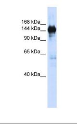 293T cell lysate. Antibody concentration: 1.0 ug/ml. Gel concentration: 6-18%.