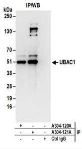 Detection of Human PFAS by Western Blot. Samples: Whole cell lysate (50 ug) from Jurkat, HeLa, and 293T cells. Antibodies: Affinity purified rabbit anti-PFAS antibody used for WB at 0.1 ug/ml. Detection: Chemiluminescence with an exposure time of 3 minutes.