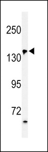 Western blot of PUR4 Antibody in HepG2 cell line lysates (35 ug/lane). PUR4 (arrow) was detected using the purified antibody.