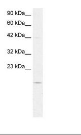 HepG2 Cell Lysate