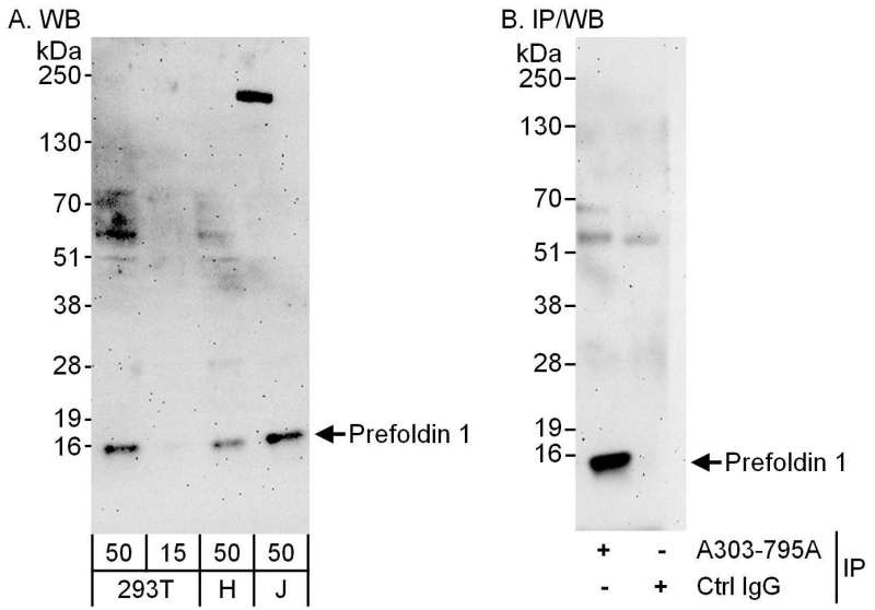Detection of Human Prefoldin 1 by Western Blot and Immunoprecipitation. Samples: Whole cell lysate from 293T (15 and 50 ug for WB; 1 mg for IP, 20% of IP loaded), HeLa (H; 50 ug) and Jurkat (J; 50 ug) cells. Antibodies: Affinity purified rabbit anti-Prefoldin 1 antibody used for WB at 1 ug/ml (A and B) and used for IP at 6 ug/mg lysate. Detection: Chemiluminescence with exposure times of 3 minutes (A and B).