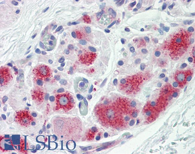 Anti-PFDN1 antibody IHC staining of human prostate, ganglion cells. Immunohistochemistry of formalin-fixed, paraffin-embedded tissue after heat-induced antigen retrieval. Antibody LS-B9889 concentration 10 ug/ml.