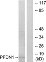 Western blot of extracts from RAW264.7 cells, using PFDN1 Antibody. The lane on the right is treated with the synthesized peptide.