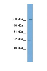 PFDN2 antibody LS-C135402 Western blot of Jurkat Cell lysate. Antibody concentration 1 ug/ml.