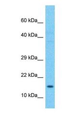Western blot of PFD2 Antibody with human Liver Tumor lysate.
