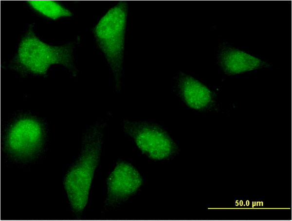 Immunofluorescence of monoclonal antibody to PFDN2 on HeLa cell . [antibody concentration 10 ug/ml]