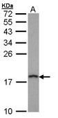 Sample (30 ug of whole cell lysate). A: Hep G2 . 12% SDS PAGE. PFDN5 / MM1 antibody diluted at 1:1000.