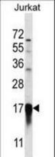 PFDN5 Antibody western blot of Jurkat cell line lysates (35 ug/lane). The PFDN5 antibody detected the PFDN5 protein (arrow).