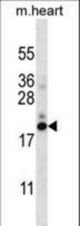 PFDN5 Antibody western blot of mouse heart tissue lysates (35 ug/lane). The PFDN5 antibody detected the PFDN5 protein (arrow).