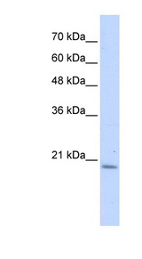 PFDN6 antibody LS-C102422 Western blot of Transfected 293T cell lysate.