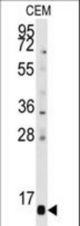 Western blot of anti-PFDN6 Antibody in CEM cell line lysates (35 ug/lane). PFDN6 (arrow) was detected using the purified antibody.