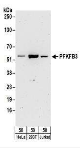 Detection of Human PFKFB3 by Western Blot. Samples: Whole cell lysate (50 ug) from HeLa, 293T, and Jurkat cells. Antibodies: Affinity purified rabbit anti-PFKFB3 antibody used for WB at 0.1 ug/ml. Detection: Chemiluminescence with an exposure time of 3 minutes.