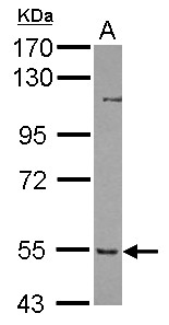 Sample (30 ug of whole cell lysate) A: Jurkat 7.5% SDS PAGE PFKFB3 antibody diluted at 1:1000