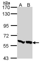 Sample (30 ug of whole cell lysate). A: A431 , B: H1299. 7.5% SDS PAGE. PFKFB3 antibody. PFK2 / PFKFB3 antibody diluted at 1:1000.