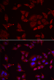 Immunofluorescence analysis of U2OS cell using PFKFB3 antibody. Blue: DAPI for nuclear staining.