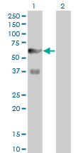 Western Blot analysis of PFKFB3 expression in transfected 293T cell line by PFKFB3 monoclonal antibody (M08), clone 3F3.Lane 1: PFKFB3 transfected lysate(59.6 KDa).Lane 2: Non-transfected lysate.