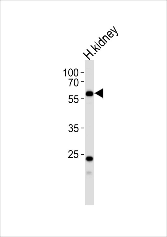 Western blot of lysate from human kidney tissue lysate, using PFKFB3 Antibody (E469). Antibody was diluted at 1:1000. A goat anti-rabbit IgG H&L (HRP) at 1:5000 dilution was used as the secondary antibody. Lysate at 35ug.