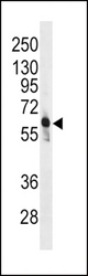 Western blot of anti-PFKFB3 Antibody in CEM cell line lysates (35 ug/lane). PFKFB3(arrow) was detected using the purified antibody.