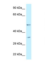 PFKFB1 antibody LS-C145350 Western blot of 1 Cell lysate. Antibody concentration 1 ug/ml.