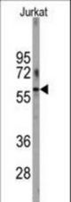Western blot of anti-PFKFB1 Antibody in Jurkat cell line lysates (35 ug/lane). PFKFB1(arrow) was detected using the purified antibody.