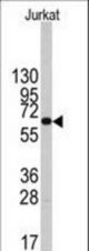 Western blot of anti-PFKFB1 Antibody in Jurkat cell line lysates (35 ug/lane). PFKFB1(arrow) was detected using the purified antibody.