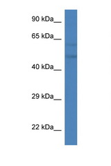 PFKFB2 antibody LS-C135390 Western blot of Mouse Liver lysate. Antibody concentration 1 ug/ml.
