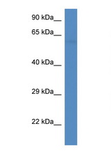 PFKFB2 antibody LS-C135389 Western blot of Mouse Heart lysate. Antibody concentration 1 ug/ml.