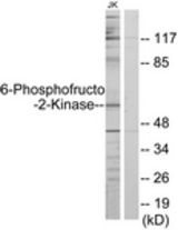 Western blot of extracts from Jurkat cells, using PFKFB2 Antibody. The lane on the right is treated with the synthesized peptide.