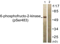 Western blot of extracts from 293 cells treated with Heat shock, using PFKFB2 (Phospho-Ser483) Antibody. The lane on the right was incubated with synthetic peptide.
