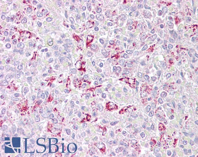 Anti-PFKFB2 antibody IHC of human spleen. Immunohistochemistry of formalin-fixed, paraffin-embedded tissue after heat-induced antigen retrieval. Antibody LS-B6492 concentration 2.5 ug/ml.