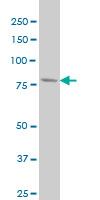 PFKL monoclonal antibody (M03), clone 2A9 Western Blot analysis of PFKL expression in HeLa.