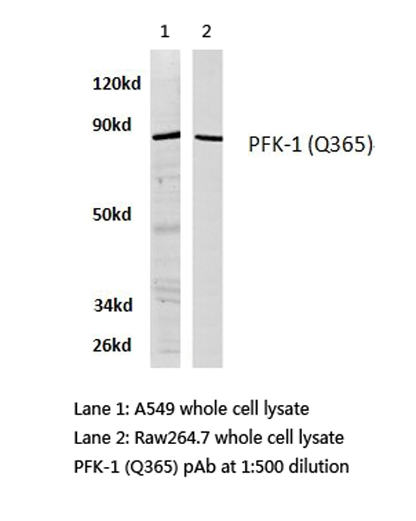 Western blot of PFK-1 (Q365) pAb in extracts from A549 and raw264.7 cell.