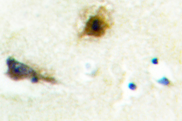 IHC of PFK-B (E724) pAb in paraffin-embedded human brain tissue.