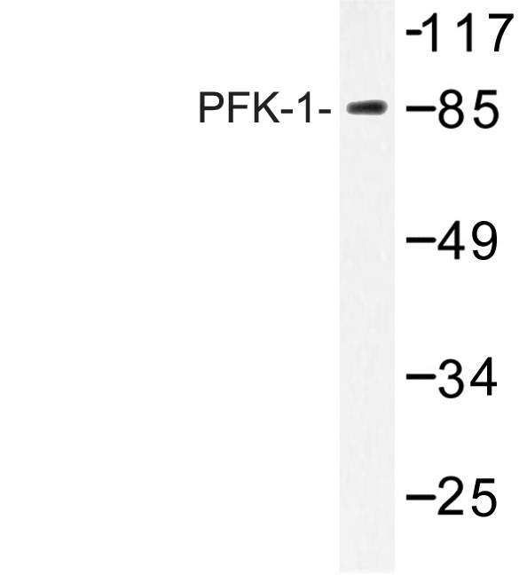 Western blot of PFK-B (E724) pAb in extracts from A549 cells.