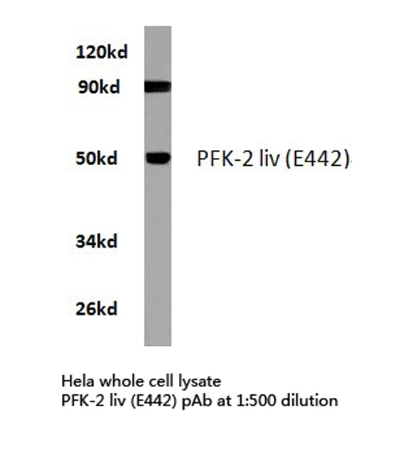 Western blot of PFK-2 liv (E442) pAb in extracts from HeLa cells.