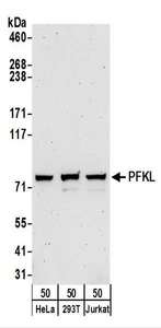 Detection of Human PFKL by Western Blot. Samples: Whole cell lysate (50 ug) from HeLa, 293T, and Jurkat cells. Antibodies: Affinity purified rabbit anti-PFKL antibody used for WB at 0.4 ug/ml. Detection: Chemiluminescence with an exposure time of 3 minutes.
