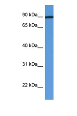 PFKM / PFK-1 antibody LS-C135936 Western blot of Fetal Heart lysate. Antibody concentration 1 ug/ml.